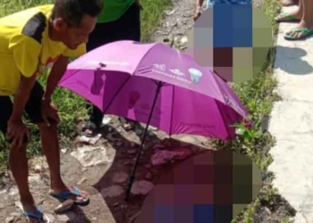 Laki-laki Gangguan Jiwa Masih Hidup Setelah Tersambar KA