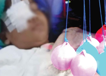 Banyak Anak-anak Jadi Korban Lato-lato, Disdik Kabupaten Cirebon Segera Keluarkan Surat Edaran ke Sekolah