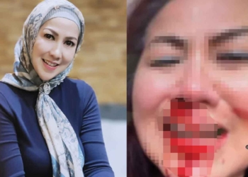 Venna Melinda Laporkan KDRT Suaminya ke Polisi, Hidung dan Mulutnya Berdarah