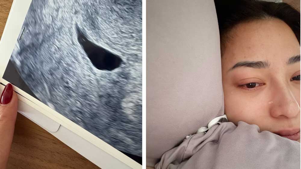 Nikita Willy Keguguran di Usia 7 Minggu, Suami Chat Hadist