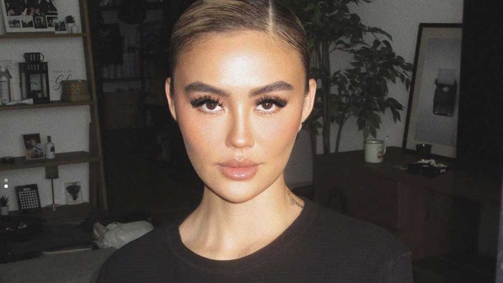 Ari Bias Laporkan Agnes Monica ke Polisi, Terancam Denda Rp1,5 Miliar