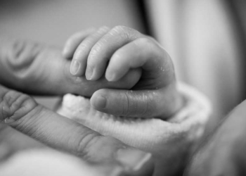 Harus Dioperasi, Jantung Bayi Kembar Siam Menyatu, Dinsos Kabupaten Cirebon Lapor ke Kemensos