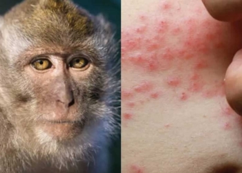 Masyarakat Diminta Taati Prokes untuk Cegah Mpox