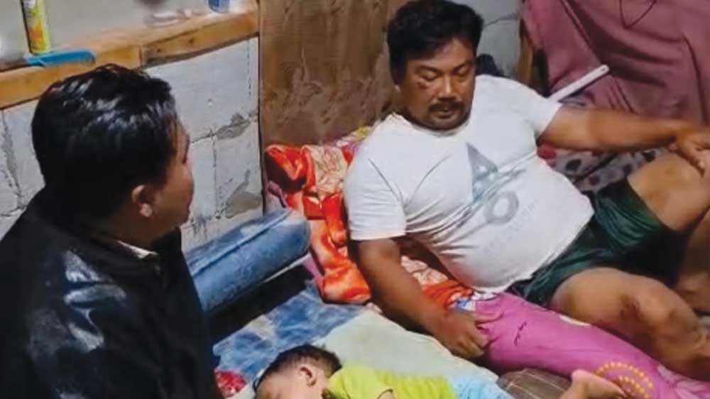 Dedi Mulyadi Bantu Pengobatan Korban Tertimpa Baliho Asih di Cianjur