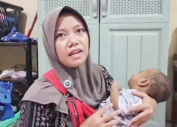 Usia Delapan Bulan Sudah Dua Kali Operasi, Anak Penderita Penyakit Langka di Cirebon Butuh Perhatian Pemda